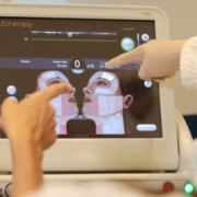 Visualizzazione ecografica nel lifting ad ultrasuoni microfocalizzati Visualizzazione ecografica nel lifting ad ultrasuoni microfocalizzati